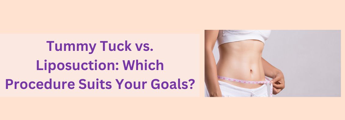 Comparison between tummy tuck and liposuction procedures for body contouring